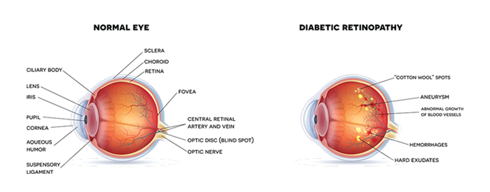 Ohio Ophthalmology Diabetic Retinopathy Conditions Treatment